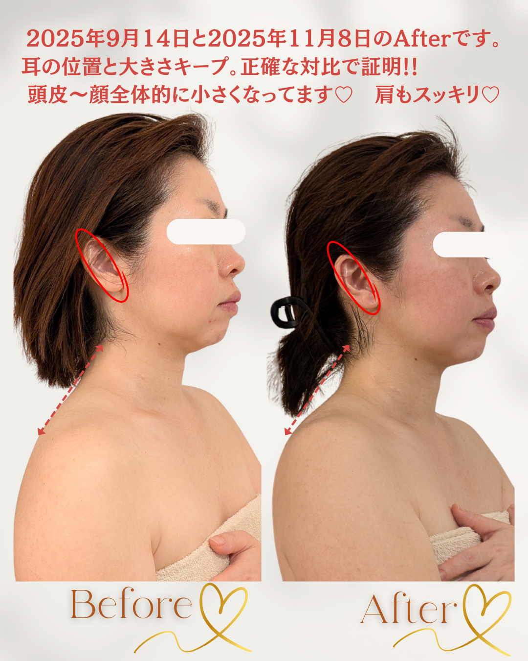 30代からの自分メンテナンス|小顔＆バストケア