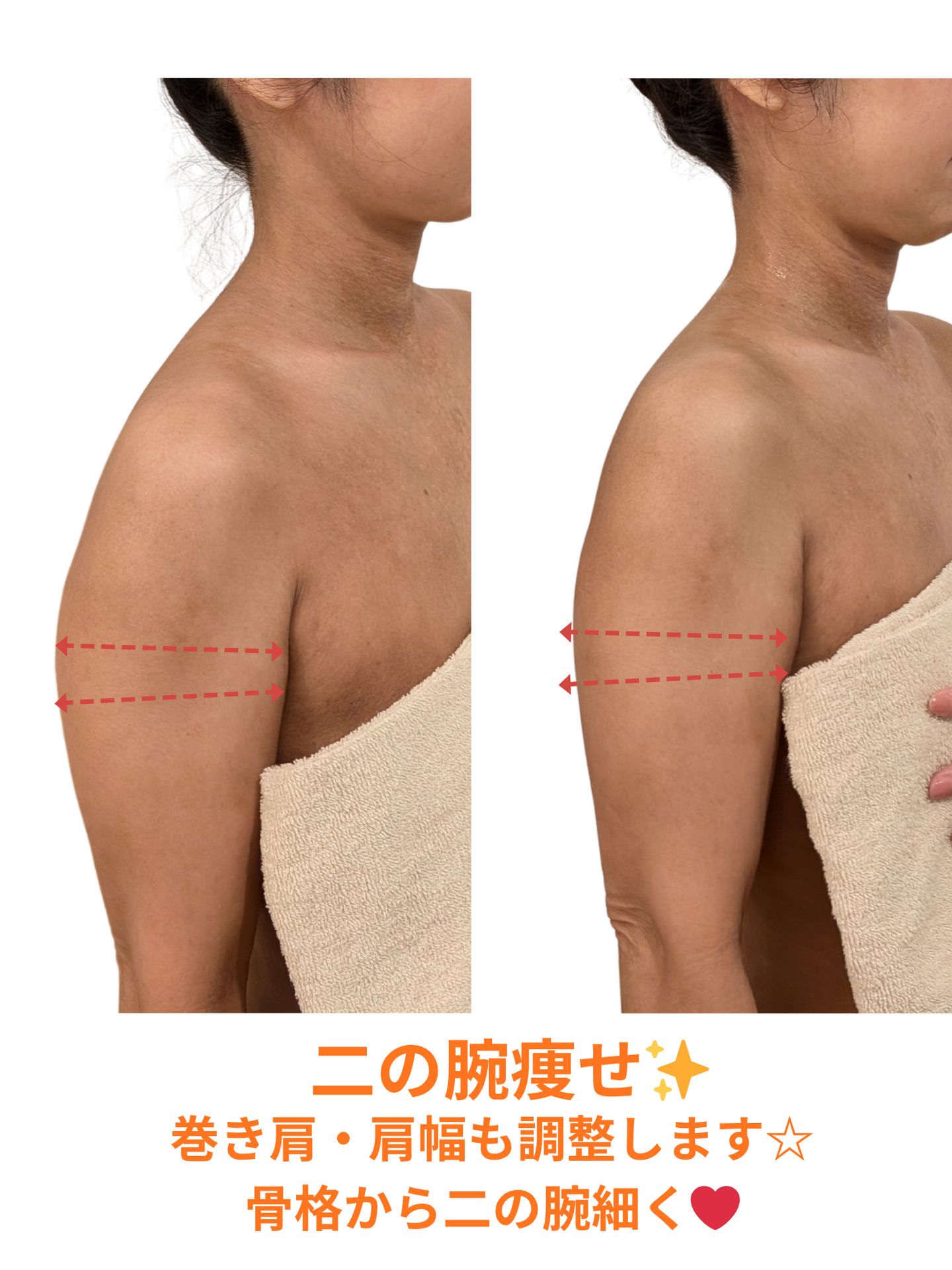 【鶴見・生麦】二の腕とはみ肉の正体は？「二の腕痩せ」の色々なアプローチ